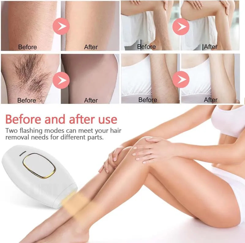 Épilateur IPL Portable Sans Douleur - Appareil Laser à Domicile pour Femmes