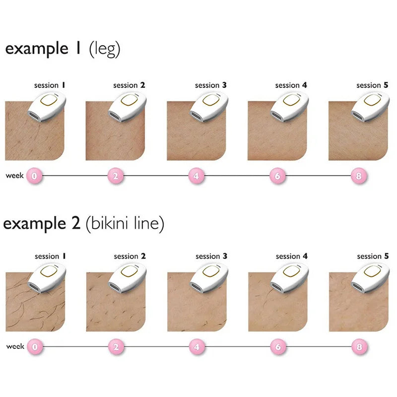 Épilateur IPL Portable Sans Douleur - Appareil Laser à Domicile pour Femmes