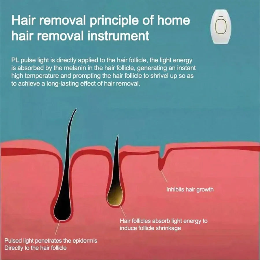 Épilateur IPL Corps Complet - Appareil Permanent pour Femmes à Domicile