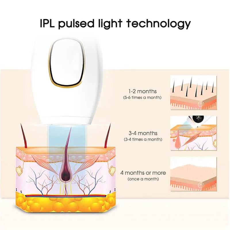 Épilateur IPL Portable Sans Douleur - Appareil Laser à Domicile pour Femmes