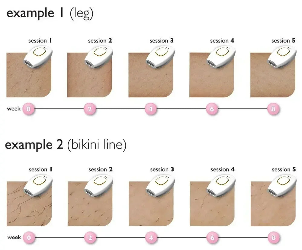 Épilateur IPL Laser Permanent 500 000 Flashs - Visage Corps Bikini Femmes