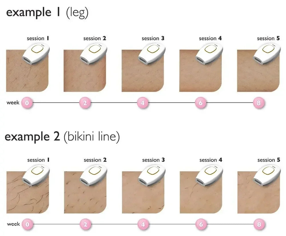 Épilateur IPL Électrique Sans Douleur 500 000 Flashs - Corps Bikini Aisselles